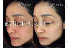 ビーホワイト(BeWhite)