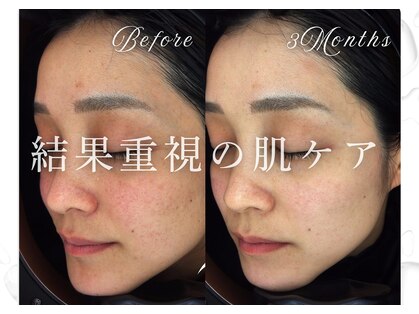 ビーホワイト(BeWhite)の写真