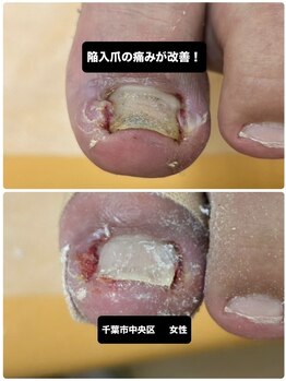 丁寧な施術で着実に改善を実感！