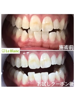 ルブラン 奈良店(Le Blanc)/このような着色汚れ