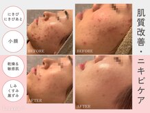 ルアナ プラス(Luana＋)