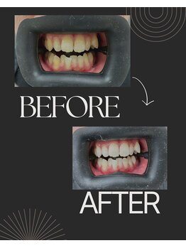 セルフダック 栃木小山店(SELFDUCK)/20代 男性 喫煙者