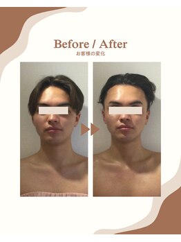 ビーキュート 学芸大学店(BE-CUTE)/Before/After 施術