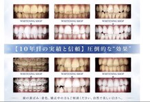 歯のホワイトニング専門店　ホワイトニングショップ京都八条口店