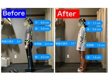 ナオル整体 仙台院(NAORU整体)/20代女性「猫背の悩み」