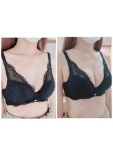 サロン ド チョコ(SALON DU CHOCO)/バストアップ症例