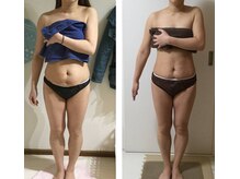 エクラ(Eclat)/ブライダル/小顔/毛穴/美白肌