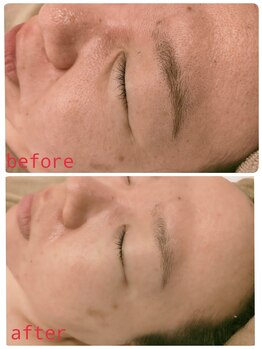 サロンドットブレスドットケイ(salon.bless.k)/return10/白玉ピーリング/