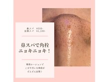 ビービー(BB)の雰囲気（大人気！【鼻スパ】¥550こびり付いた角栓もニョキニョキ）