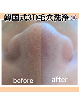 ホワイトニング ショップ 金沢店/毛穴洗浄/老若男女問わず大歓迎