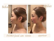 パリワール(pariwar)/インディバ＊ビフォーアフター