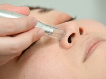 ベルフィオーレ 福島店 /毛穴フェイシャル