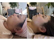 16年培った「結果出し」×「リラックス」のフェイシャル手技。