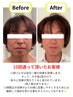 【小顔コルギ＆首肩背中ケア】左右差・歪み改善★小顔コルギ　60分