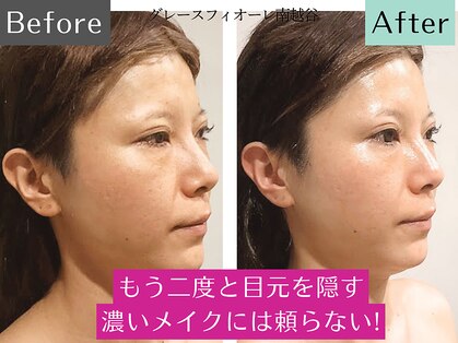 グレースフィオーレ 南越谷店(gracefiore)の写真
