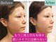 グレースフィオーレ 南越谷店(gracefiore)の写真