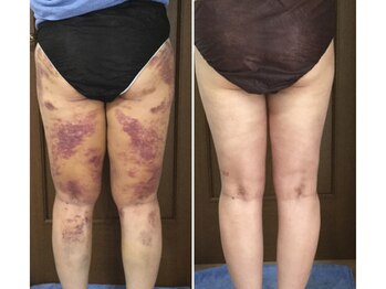 インディバ痩身サロン プルミエ(premier)