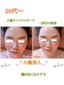 オールハンド【速効小顔★匠技】食いしばり＆顔微調整むくみ 90分 ¥15000→