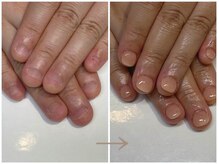 アーバンネイル/深爪矯正/ナチュラルカラー