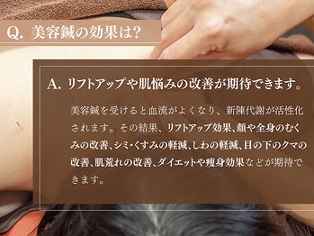 鍼灸ライフ整骨院/美容鍼の効果は？