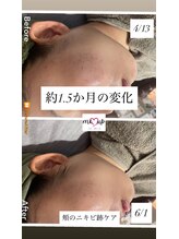 ミーアップ(Me up)/光フォト