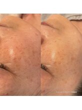 エクラ(eclat)/クリスティーナ