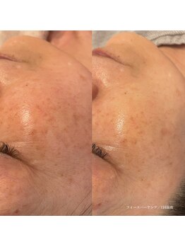 エクラ(eclat)/クリスティーナ