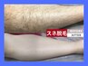 【清潔感UP×長期間効果持続】メンズ全身脱毛★夏集中コース／返金保証あり！
