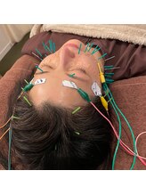 蒼月(aotsuki)/美容鍼