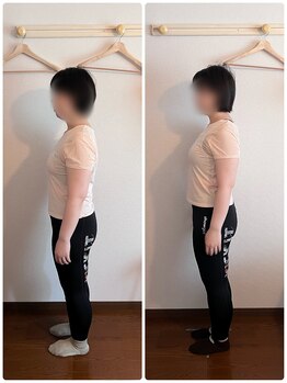 ステラ 武蔵小杉(Stella)/美骨エステ B/A