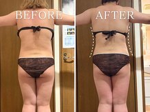 ヨサパーク ニコナ 三軒茶屋南口(YOSA PARK nicona)/ルルオンダイエット、3回目途中