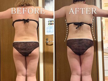 ヨサパーク ニコナ 三軒茶屋南口(YOSA PARK nicona)/ルルオンダイエット、3回目途中