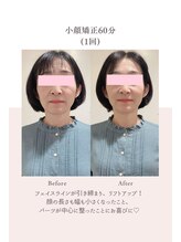 トゥインクル 麻布(twinkle)/南麻布/小顔矯正/勝山式美容矯正