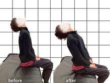 体の状態を確認してから施術を行います