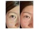 for you HBL,Nailの写真