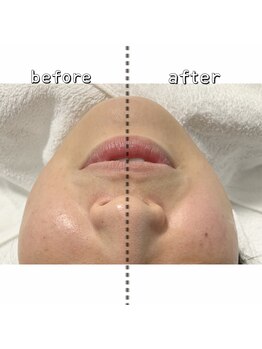 エクスクラメーションマーク(!!!)/片側のみ照射!