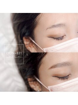 リヨン(LYON+831)/