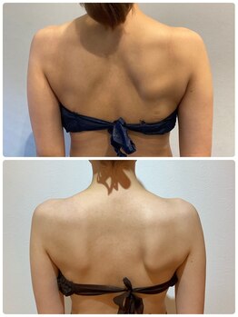 痩せラボ/天使の輪【ブライダル】