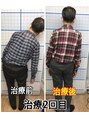 六甲もり鍼灸整体院 背骨の歪みに関してお悩みでしたらご相談ください!
