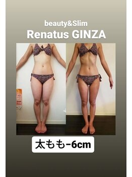 レナトゥス 銀座(Renatus)/