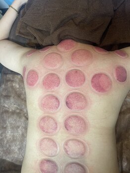 リベル(Liber)/疲れている身体の中身もわかる