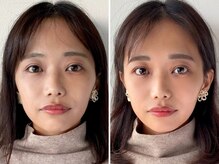 キリっと美人に◎お客様施術Before＆After