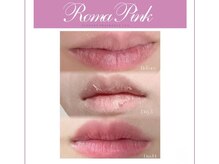 キワミビューティ(KIWAMI BEAUTY)の雰囲気（黒ずみ除去　ローマピンク導入しました！感動の赤ちゃんピンク）