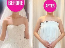 ティアエ(T-ae)/【ブライダルエステ】