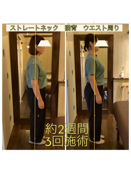 ヒカリノキュウジツ(Hikarino休日)/ストレートネック　猫背　骨盤