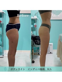 ノット(KNOT)/ボディライン　Before/After