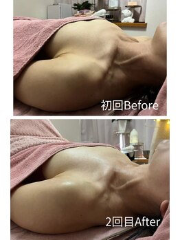 チュラ 大宮店(Chura)/【50代】バストアップ2回目@大宮