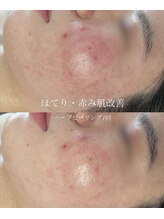 ウェリスト まこトレ整体院(WELIST)/before after