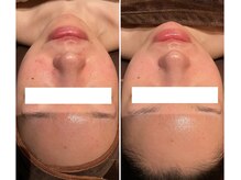 チェンジ(Change)/