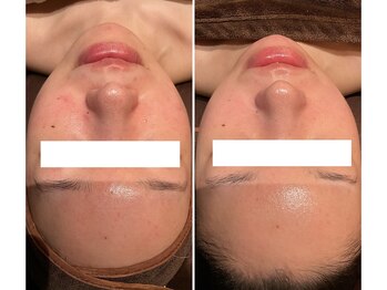 チェンジ(Change)/